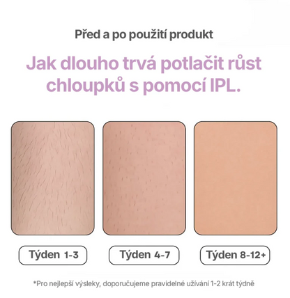 LUNERIA: IPL Laserový Odstraňovač Chloupků